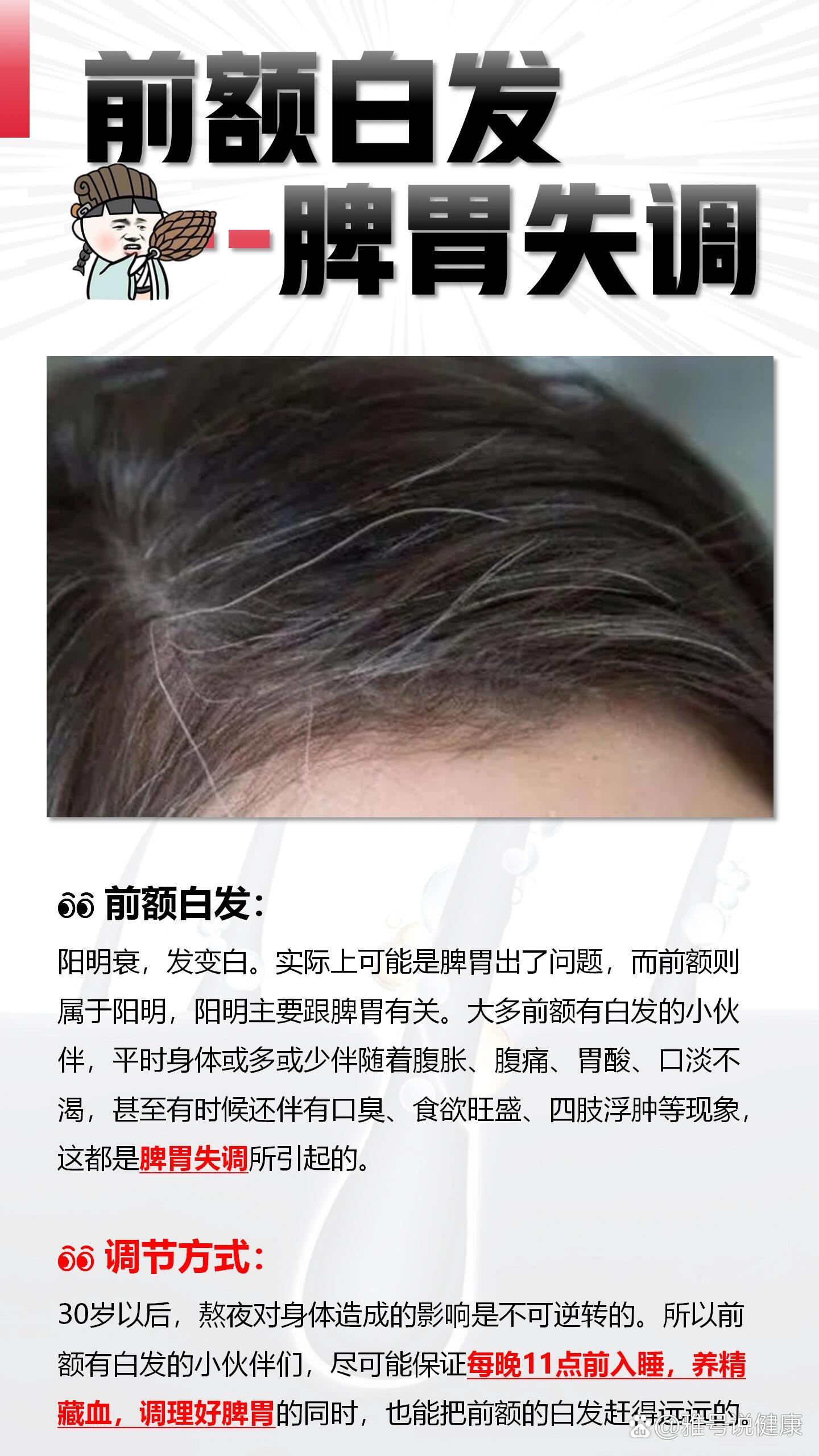 女生长白头发的原因，多重因素探究